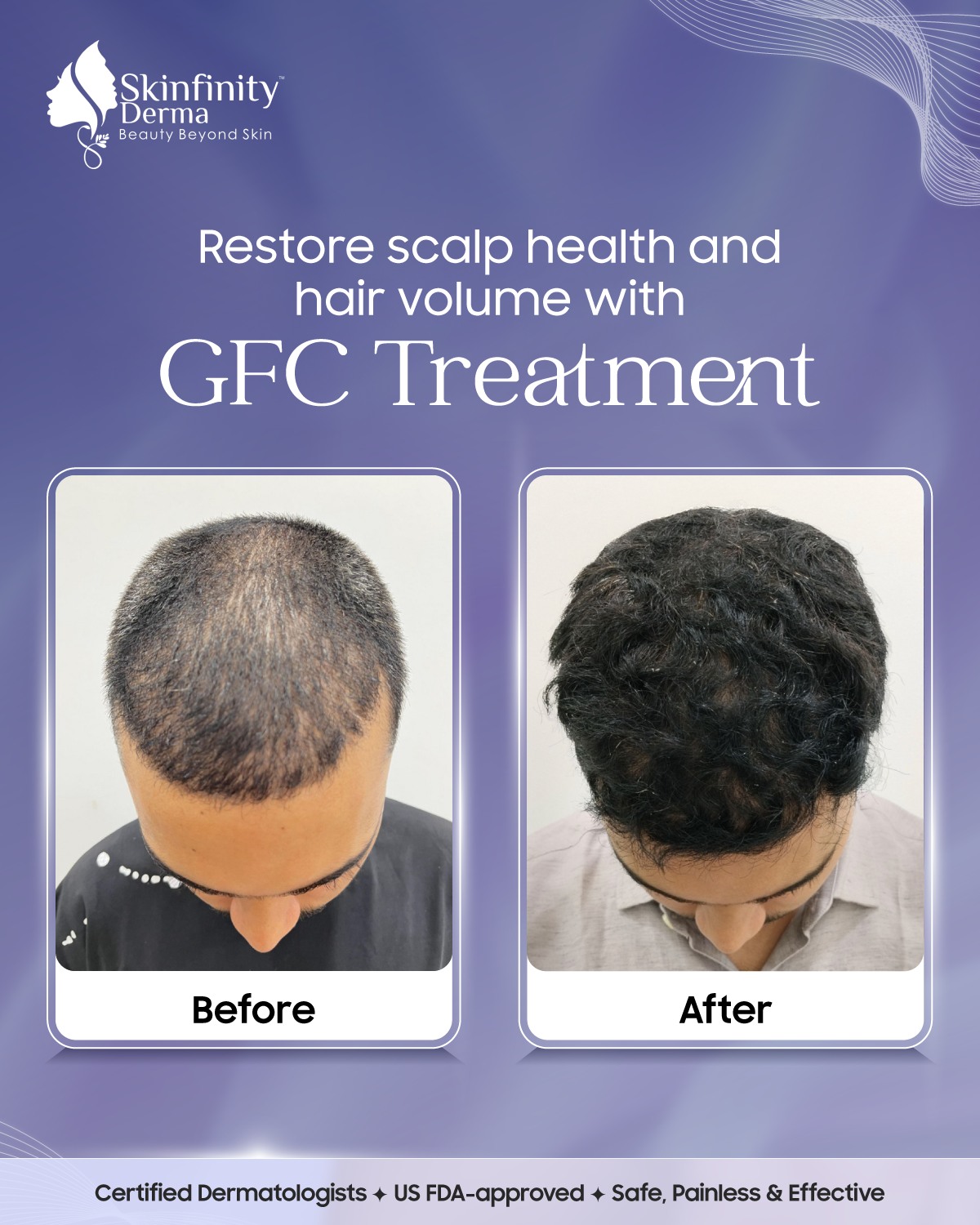 Skinfinity Derma Skin, Hair and Laser clinic Facebook ad
