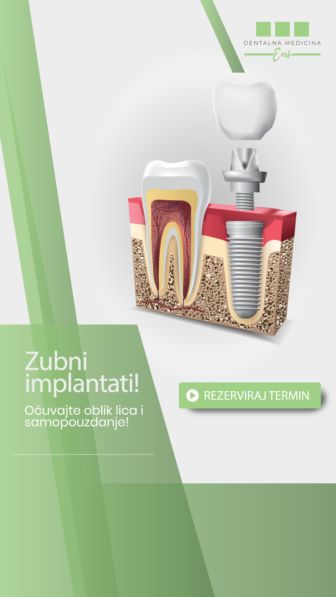 Dentalna medicina Ereš Facebook ad from Dec 2, 2025