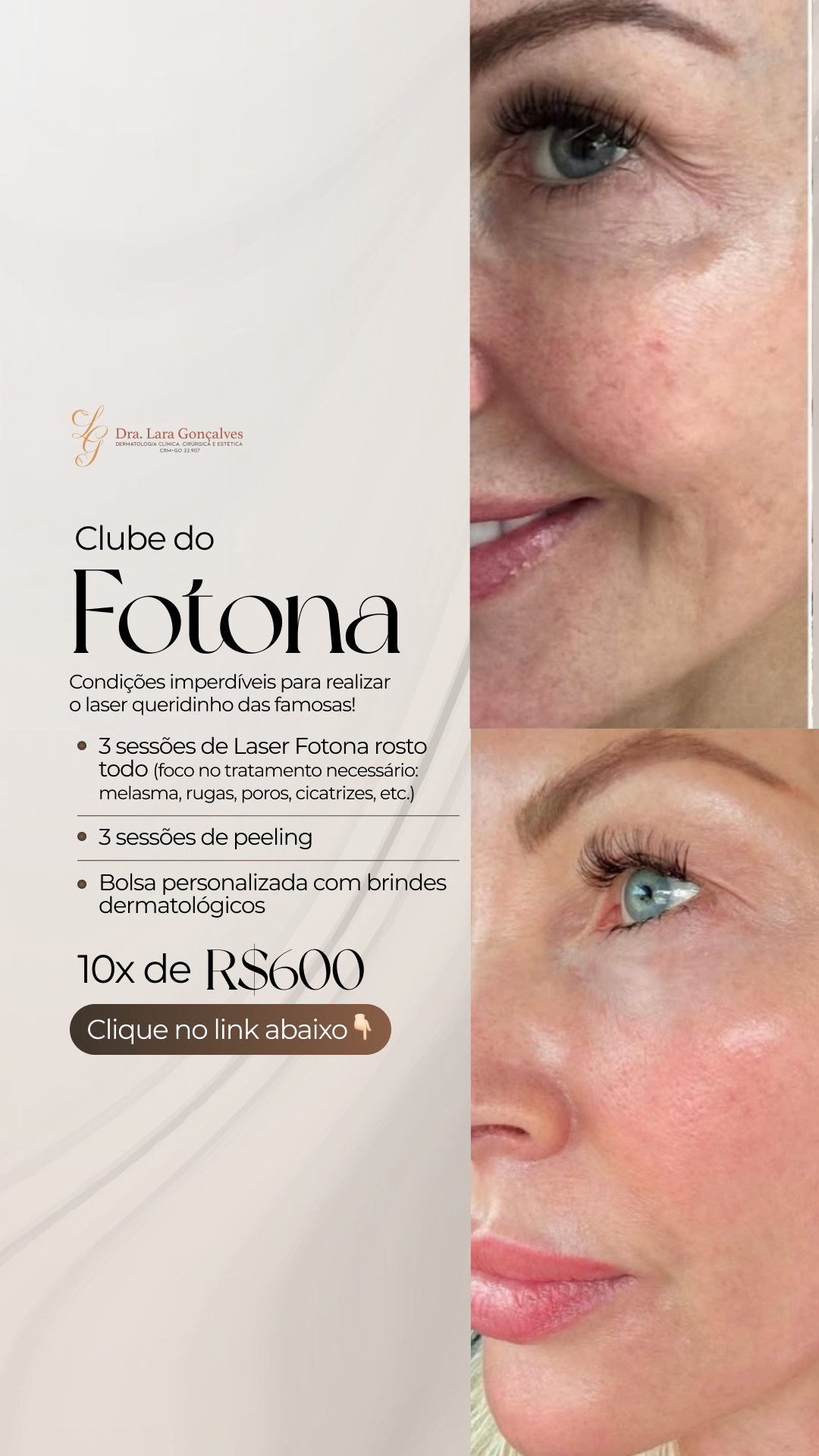 Dra. Lara Gonçalves Dermato Facebook ad from Feb 25, 2026