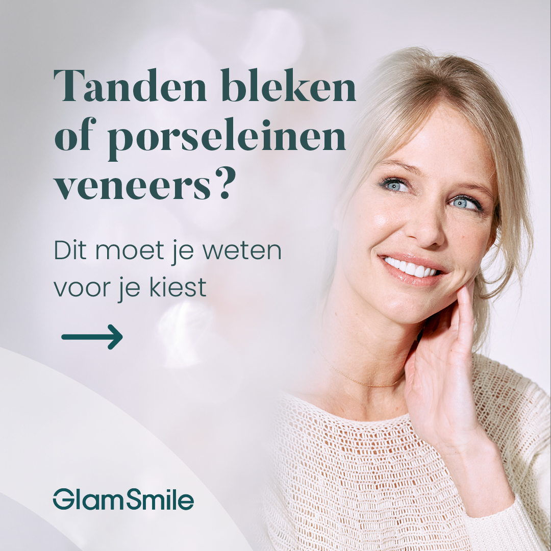 GlamSmile Belgium Facebook ad