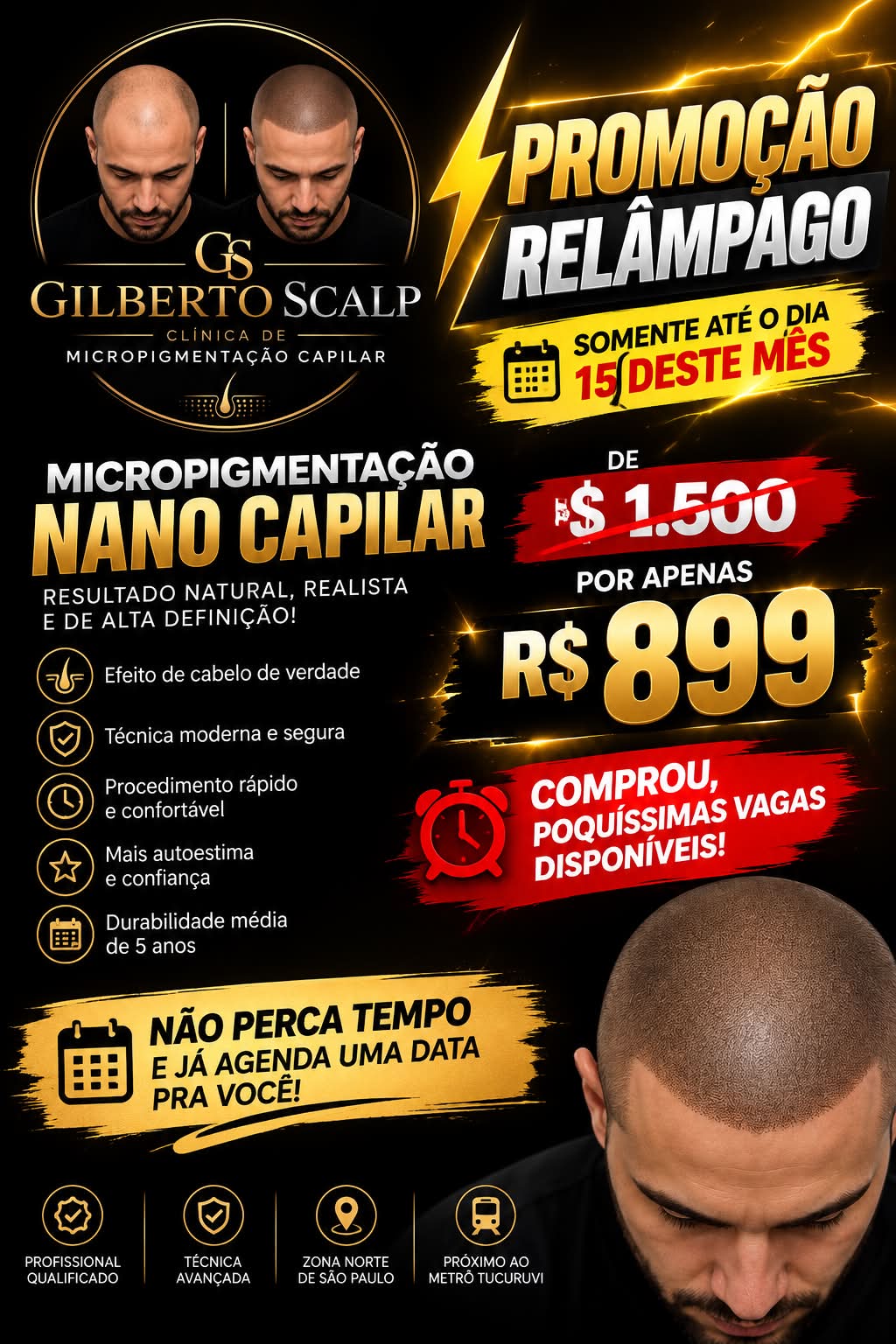 Gilberto ππππ₯π© Facebook ad: PromoΓ§Γ£o relΓ’mpago micro pigmentaΓ§Γ£o na no capilar deβ¦