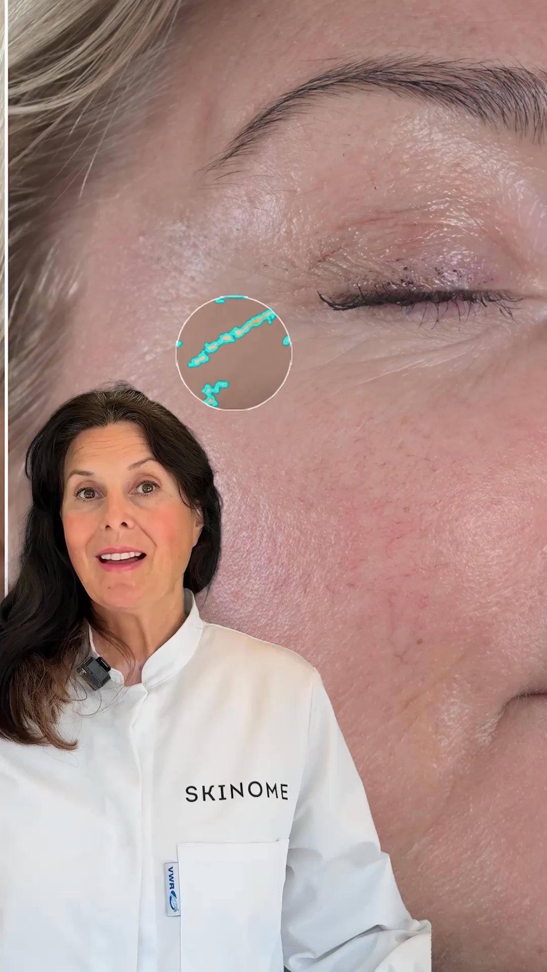Skinome Facebook ad: x10 more effective than retinol