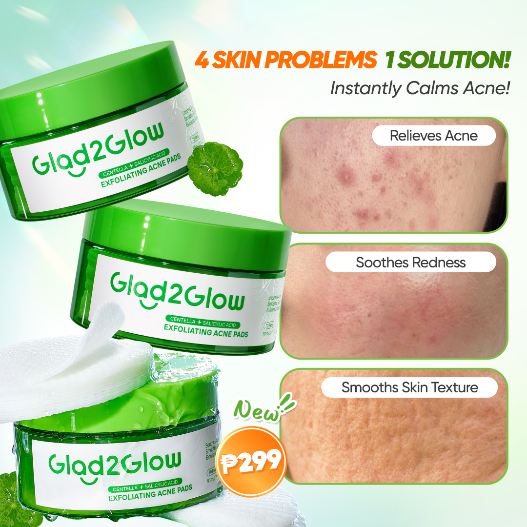 Glad2Glow'Philippines Facebook ad