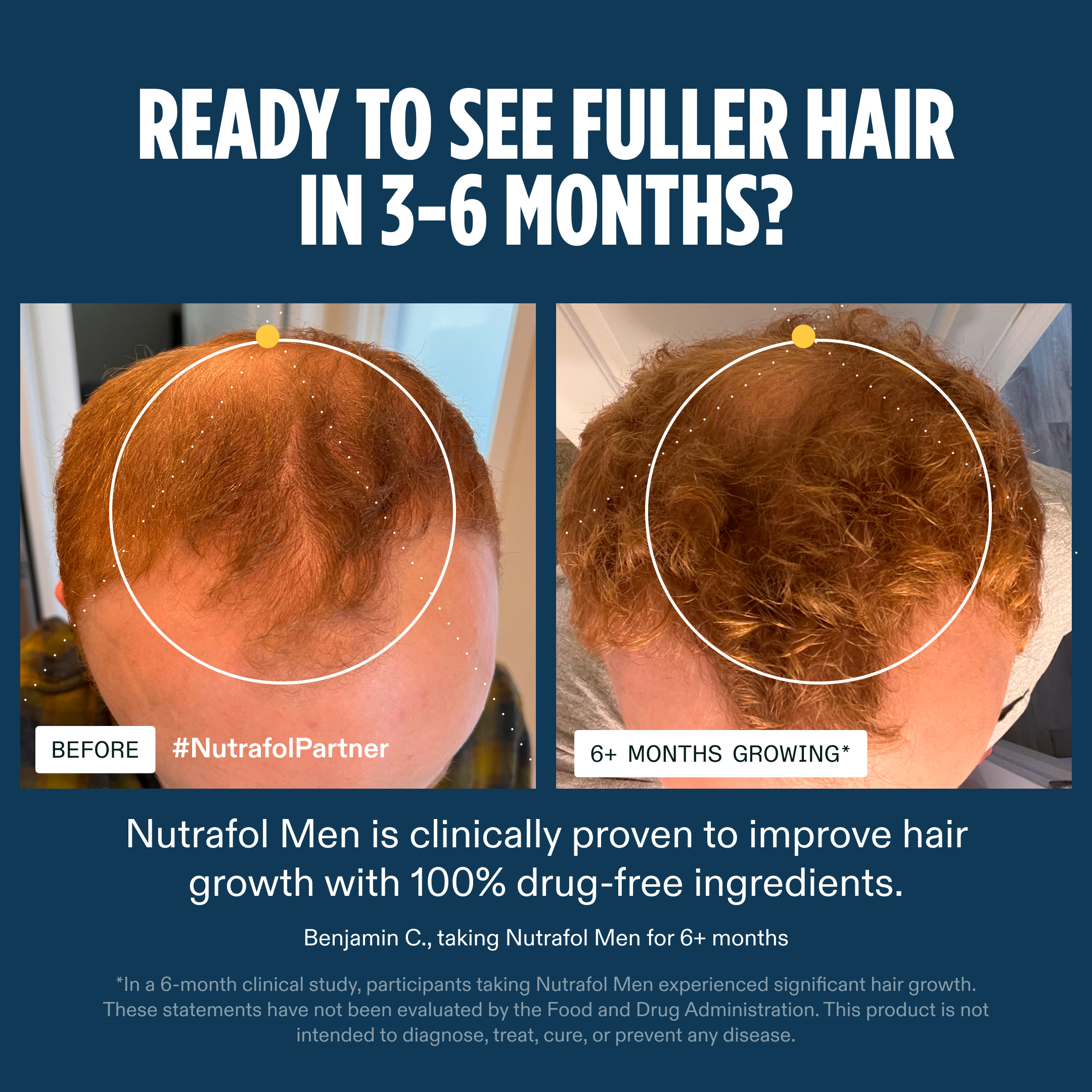 Nutrafol Men Facebook ad