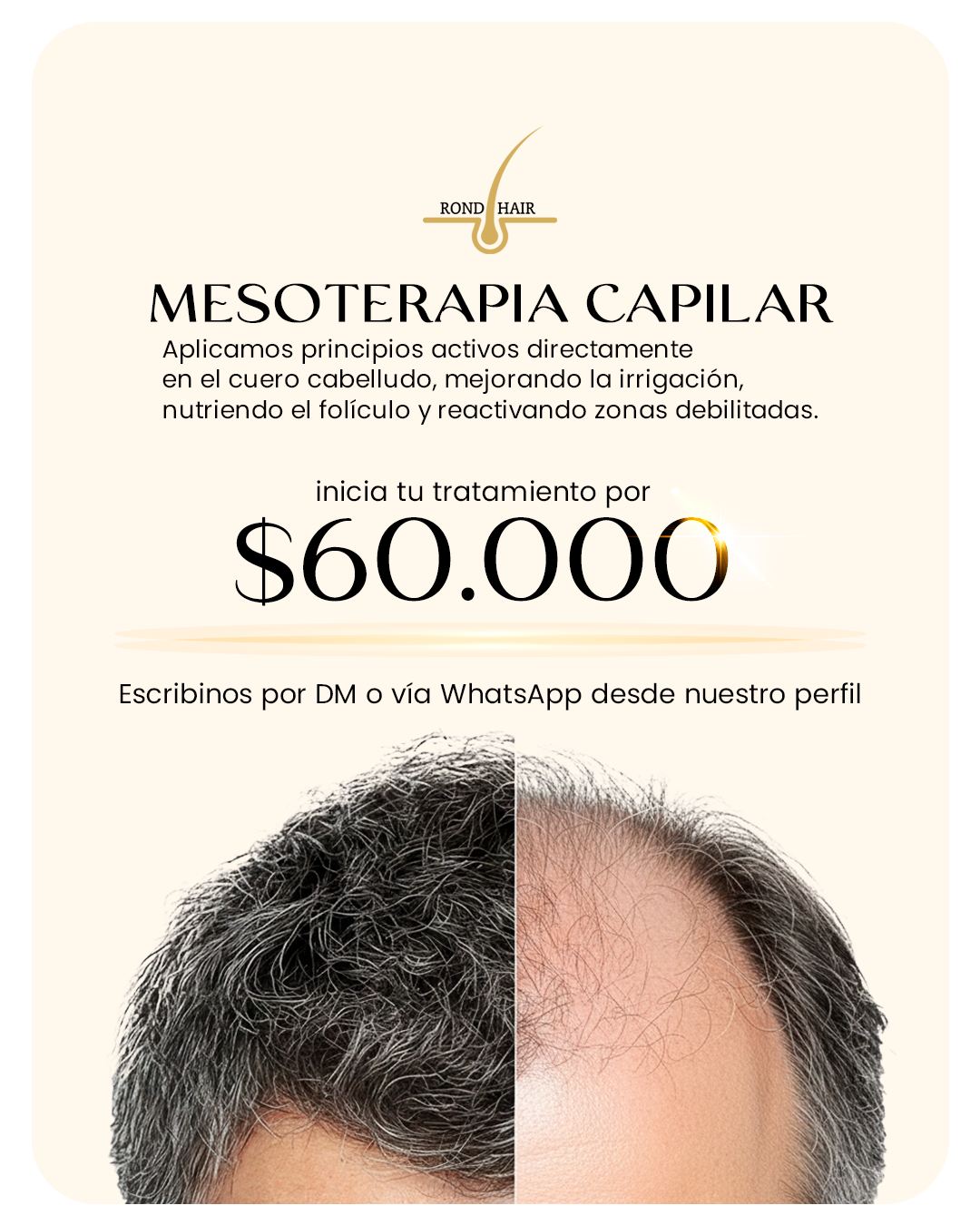Rondi Hair Facebook ad: Recuperá la vitalidad de tu cabello.