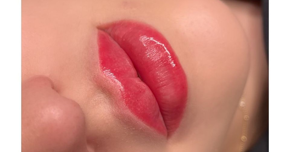 Laser-Clinic Radom Facebook ad: Salon Kosmetologii Profesjonalnej Laser Clinic Radom…