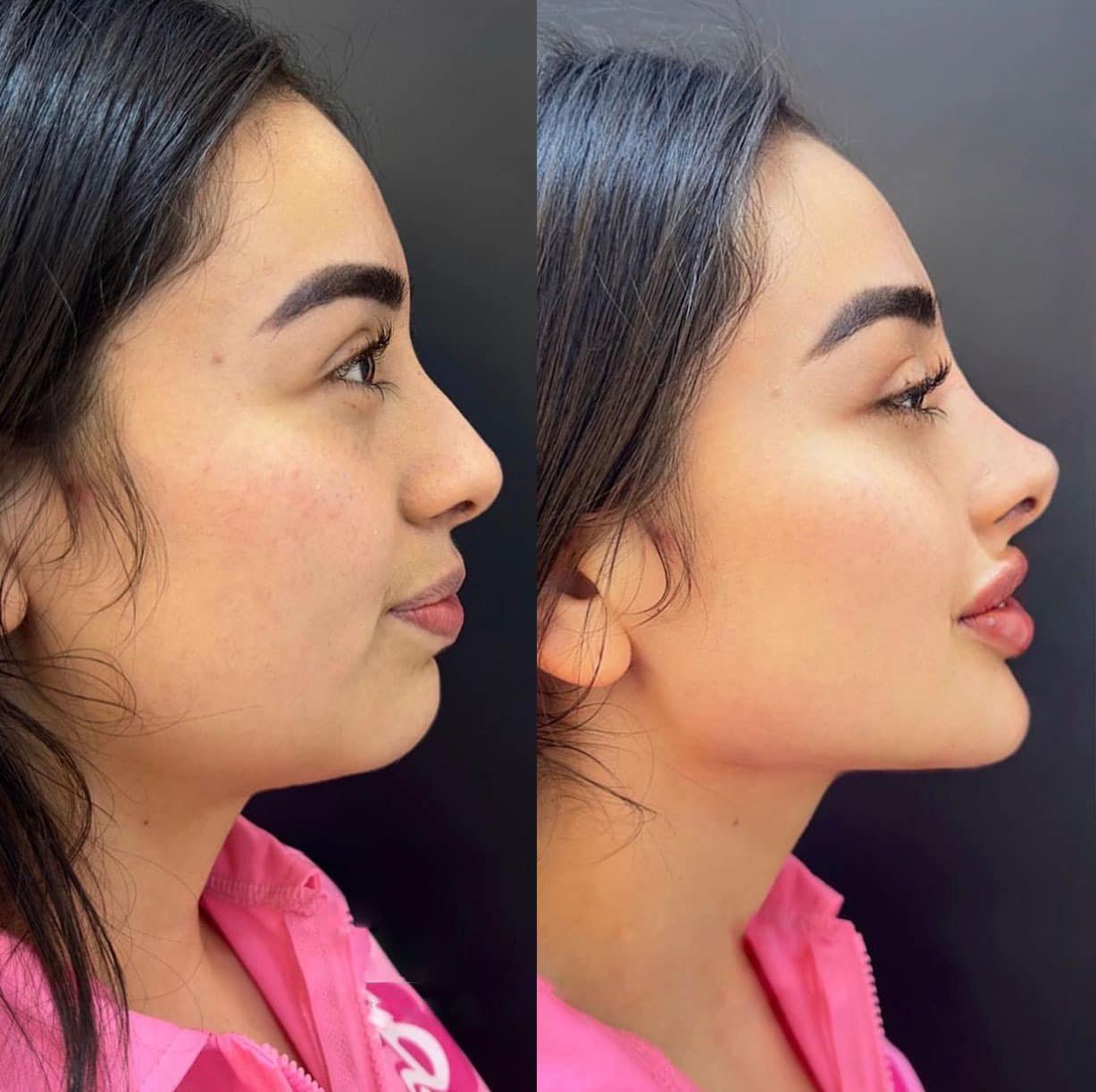 Clinica spa arte cuerpo  Facebook ad