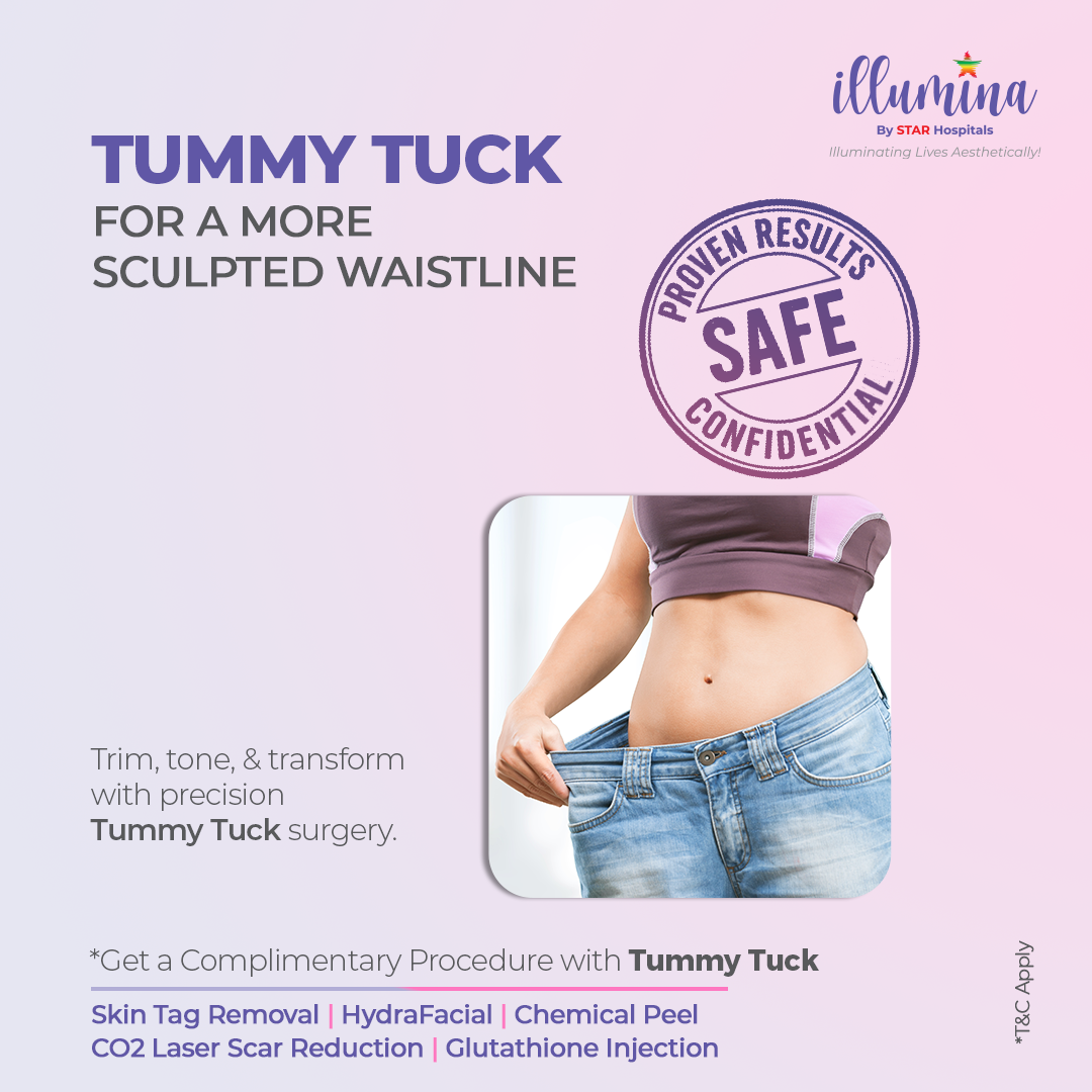 Illumina by Star Hospitals Facebook ad: Looking for safe, advanced cosmetic care?