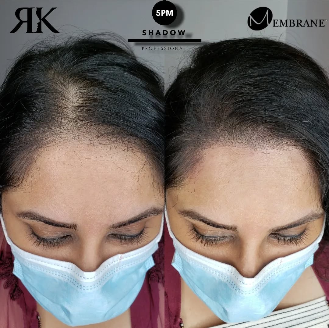 RK Scalp Micropigmentation Facebook ad