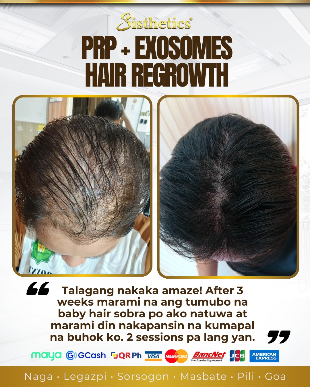 Sisthetics Masbate City Facebook ad: ๐๐ฟ๐ผ๐บ ๐ต๐ถ๐ฑ๐ถ๐ป๐ด ๐๐ป๐ฑ๐ฒ๐ฟ ๐ฎ ๐ต๐ฎ๐ ๐๐ผโฆ