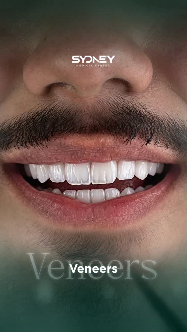 Sydney Dental Facebook ad: فينير الأسنان في سيدني مختلف