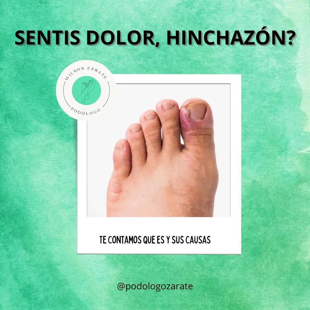 Podologo W. Zarate Facebook ad