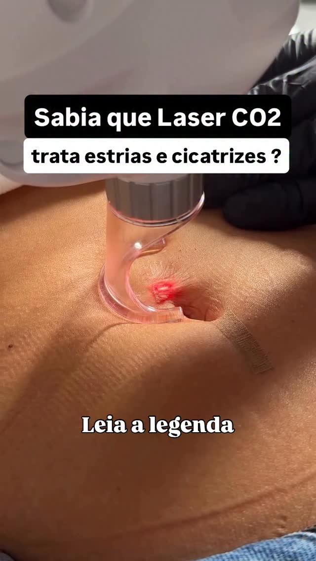 Dr. Newton Freitas Facebook ad: O laser CO₂ fracionado vai muito além do…