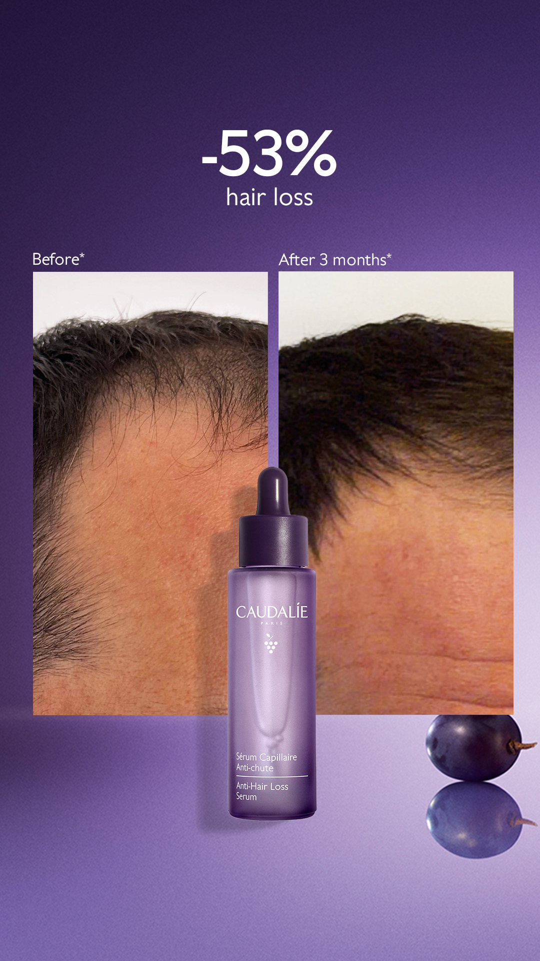 Caudalie Facebook ad