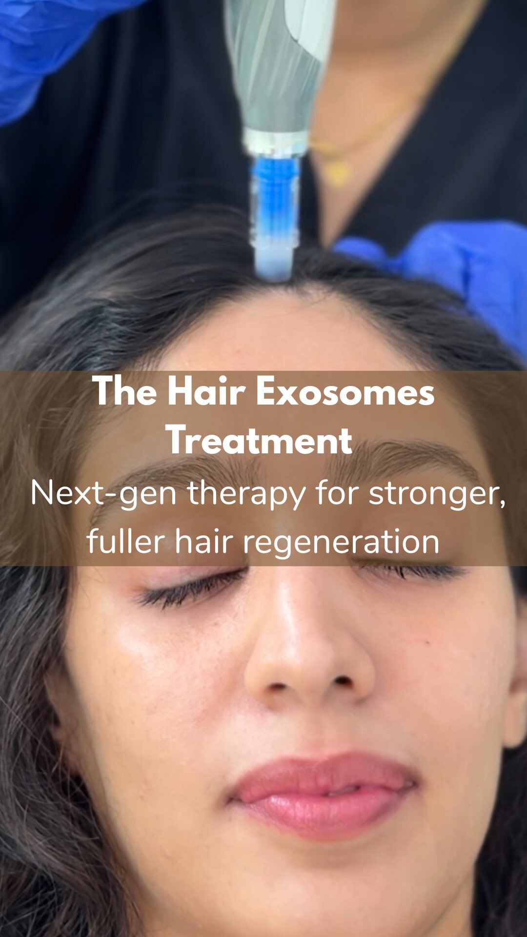 The Bombay Skin Clinic Facebook ad: Introducing the Exosome Hair Regeneration Treatment