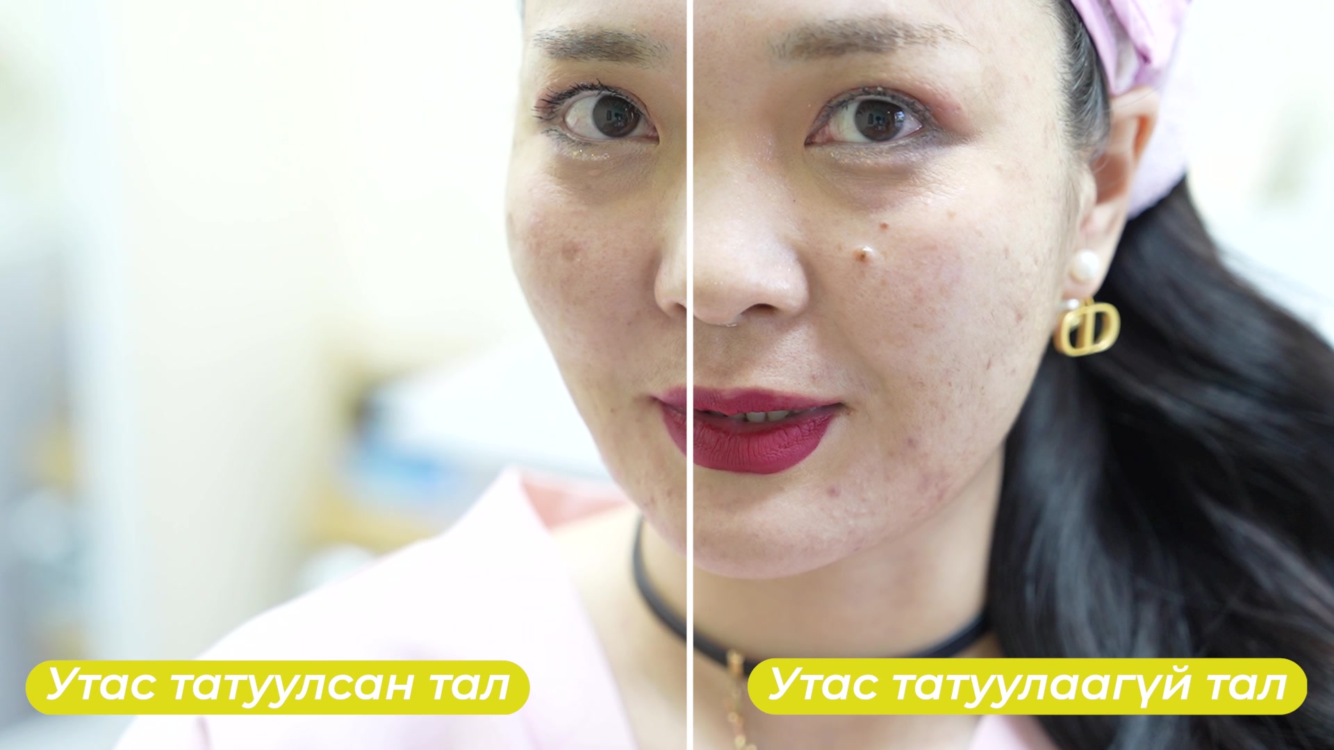 Bella Viso Clinic Facebook ad: 2,000,000₮ бэлэг авах нь BellaViso Aesthetic Clinic…