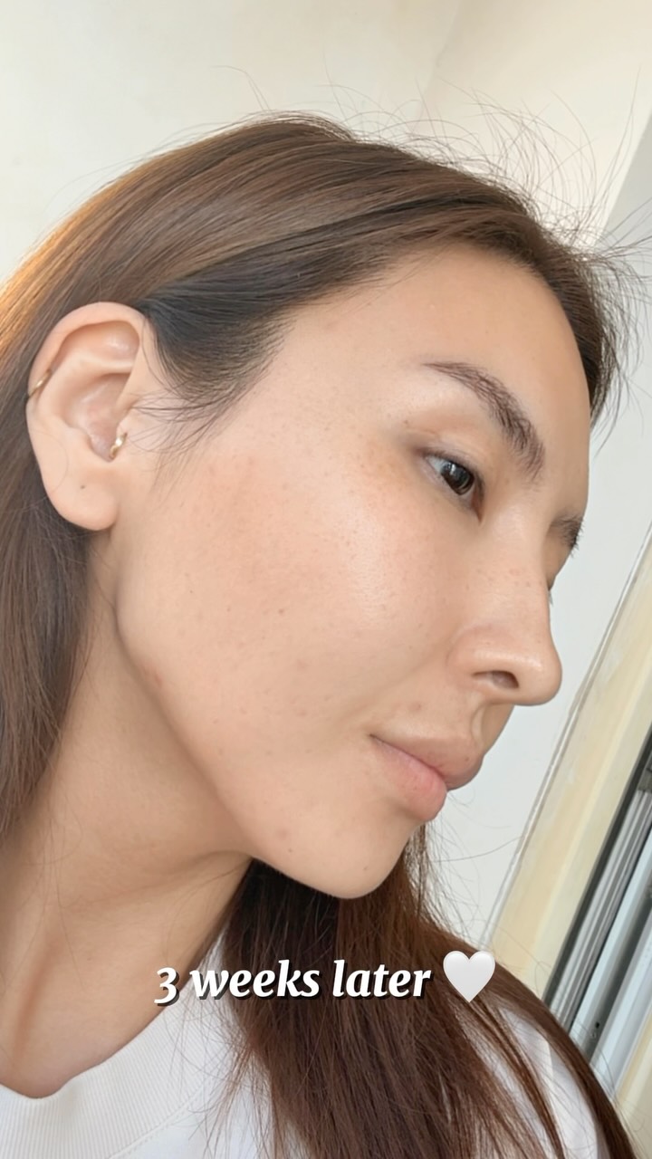 Meliora Dermatology Clinic /Мелиора арьс гоо заслын эмнэлэг Facebook ad: Skin Journey 2