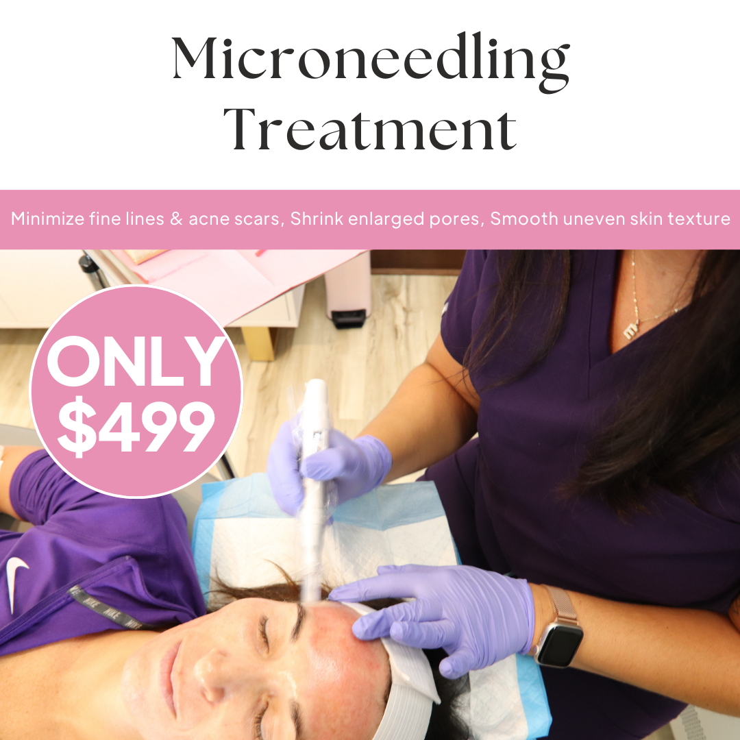 Aesthetically Yours Facebook ad: $499 PRP Microneedling Treatment!