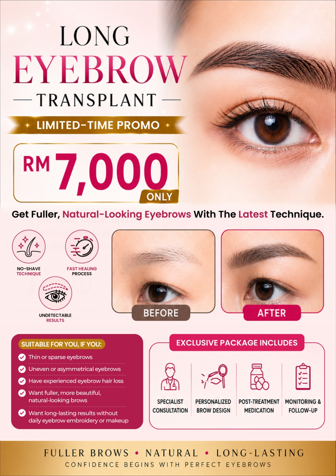 Glojas FUE Hair Transplant Specialist Malaysia Facebook ad from Jun 18, 2026