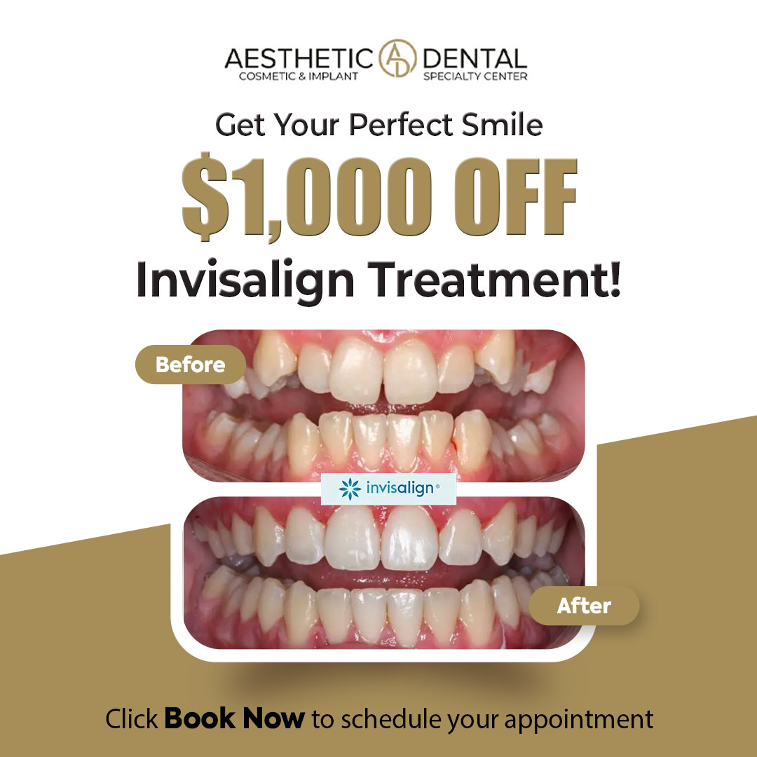 Aesthetic Dental & Specialty Center Facebook ad: Invisalign Provider in Santa Clarita!
