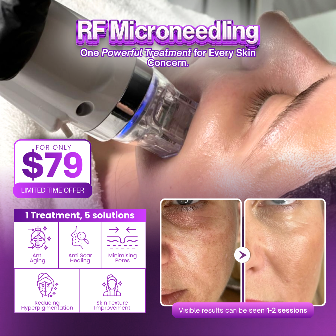 I Love Skin Treatments Facebook ad