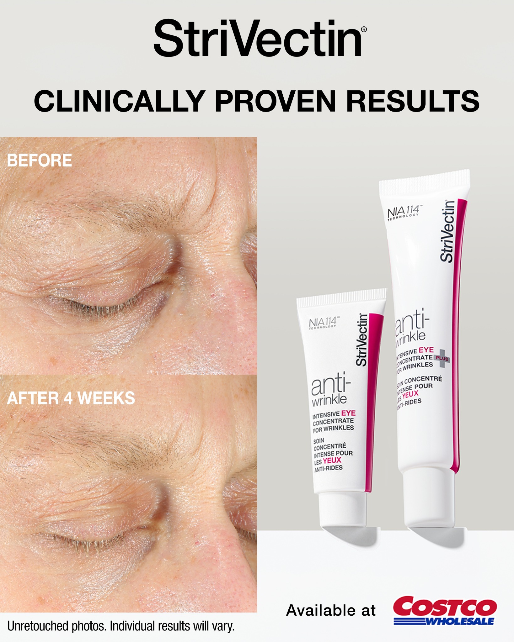 StriVectin Facebook ad