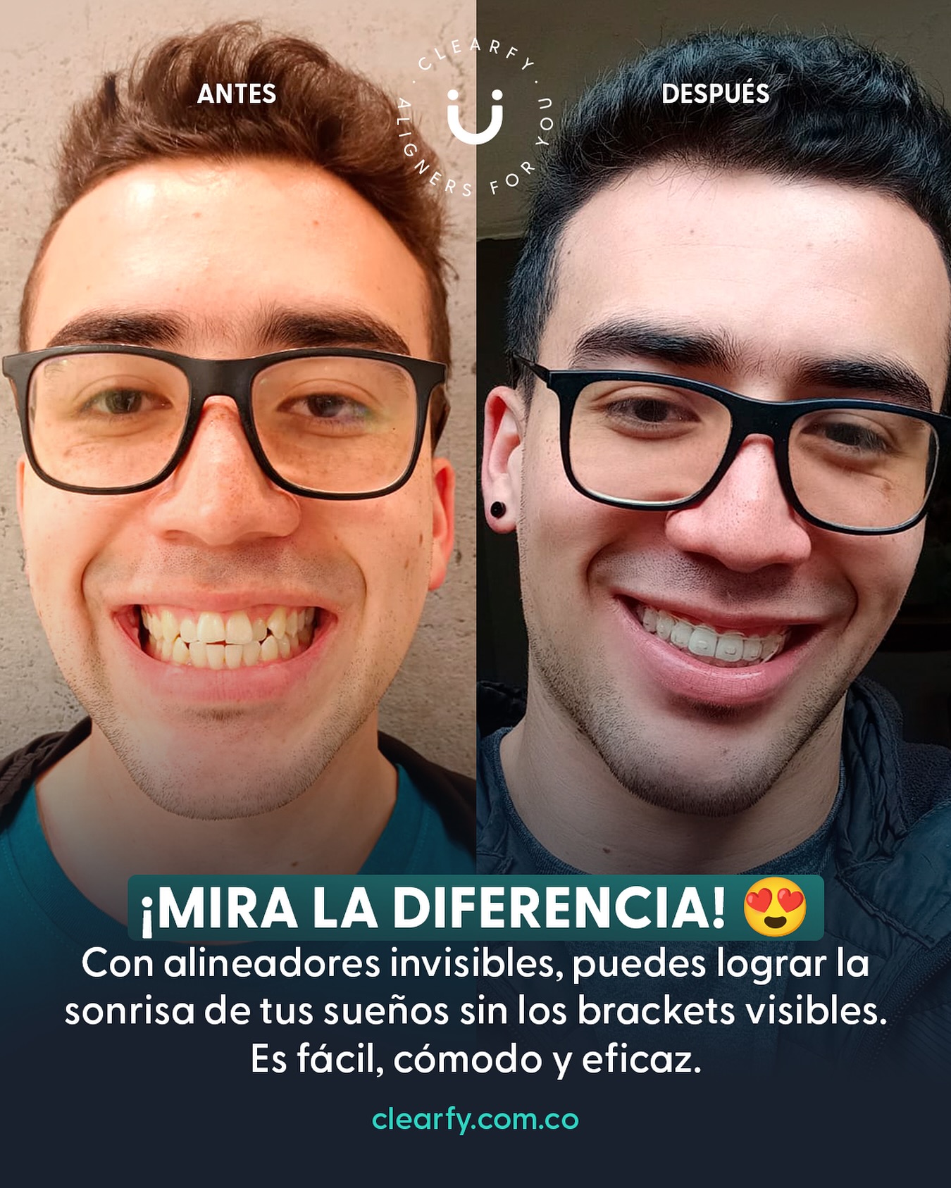 Clearfy Colombia Facebook ad