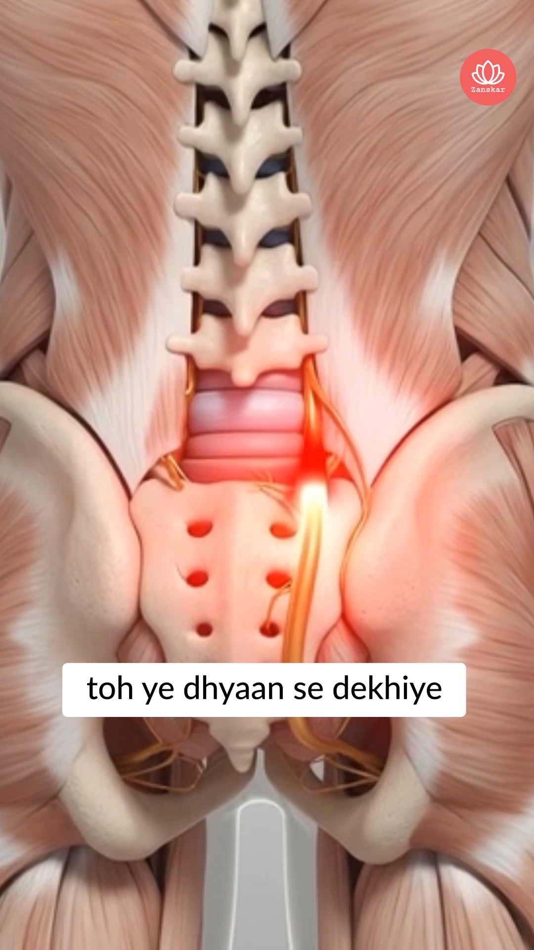 Doctor's Diary Facebook ad: The 3-Stage Fix for Sciatica Nerve Pain