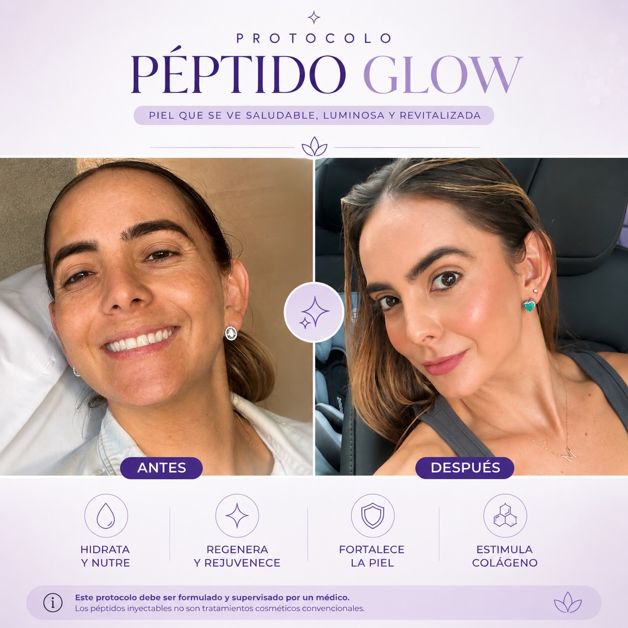 Longebii Facebook ad: Así se ve una piel con efecto GLOW