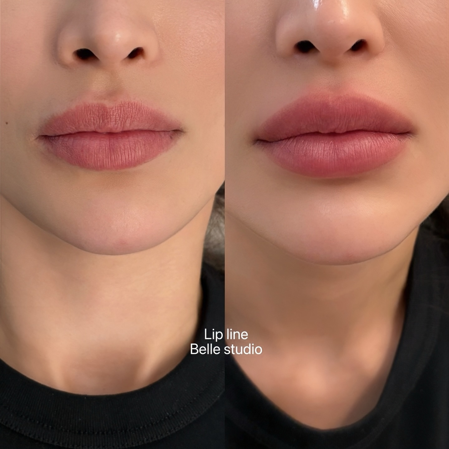 b.elle_studio Facebook ad: Lip line