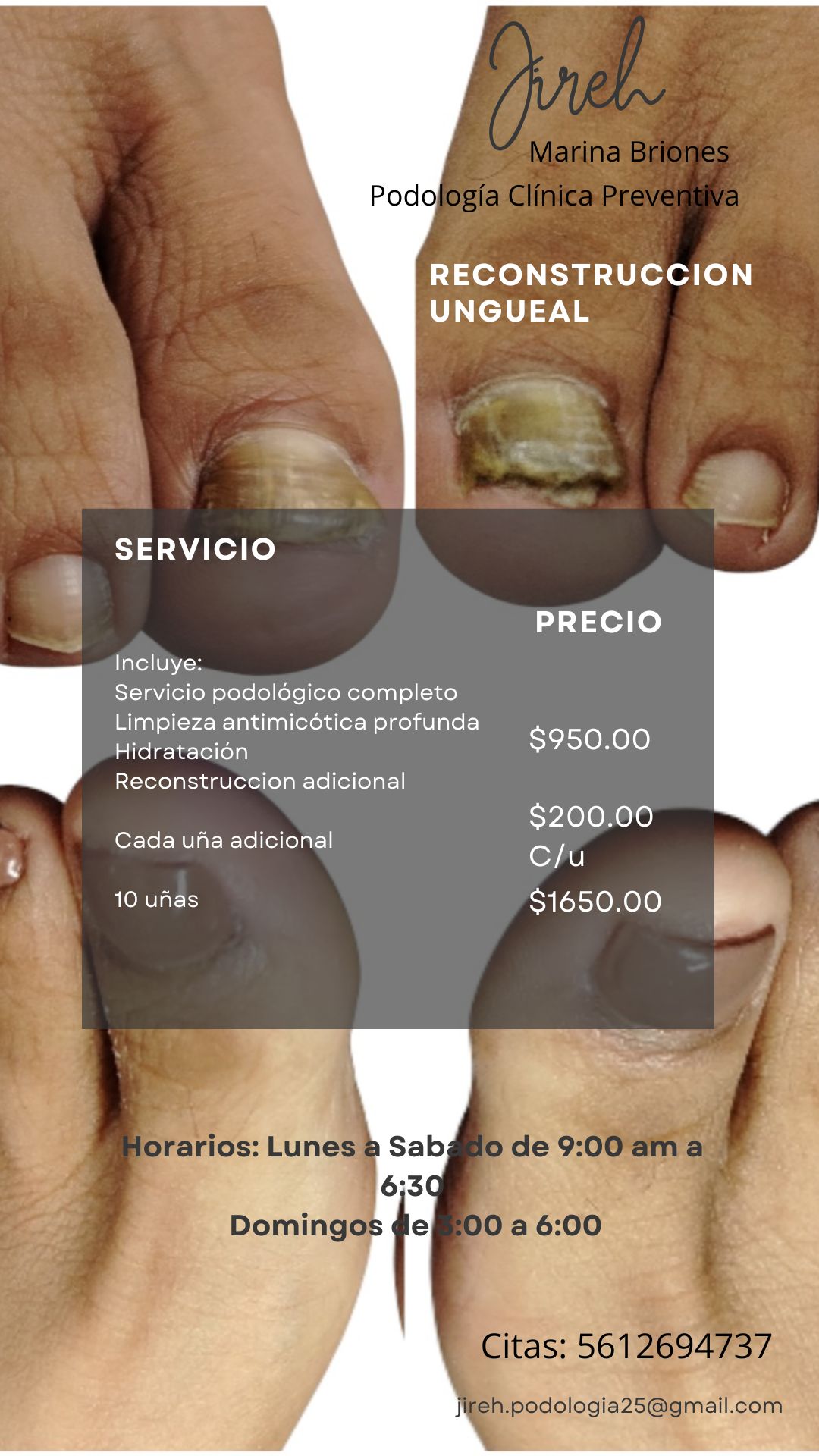 Salud y Estética Podológica Jireh Facebook ad: UÑAS CON HONGOS, DAÑO O FRACTURAS