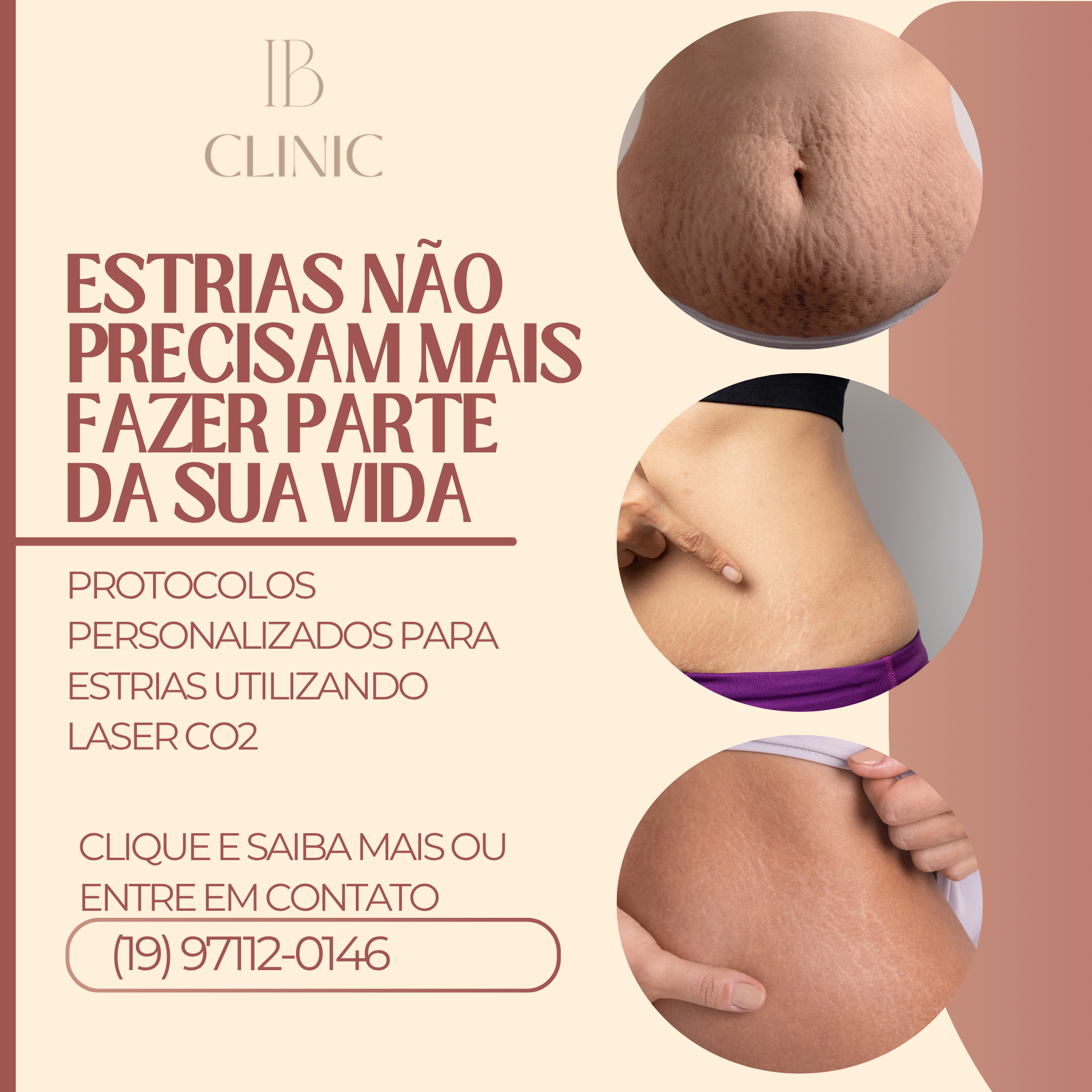 IB Clinic Boulevard Mogi Guaçu Facebook ad: Entre em contato e Saiba Mais >