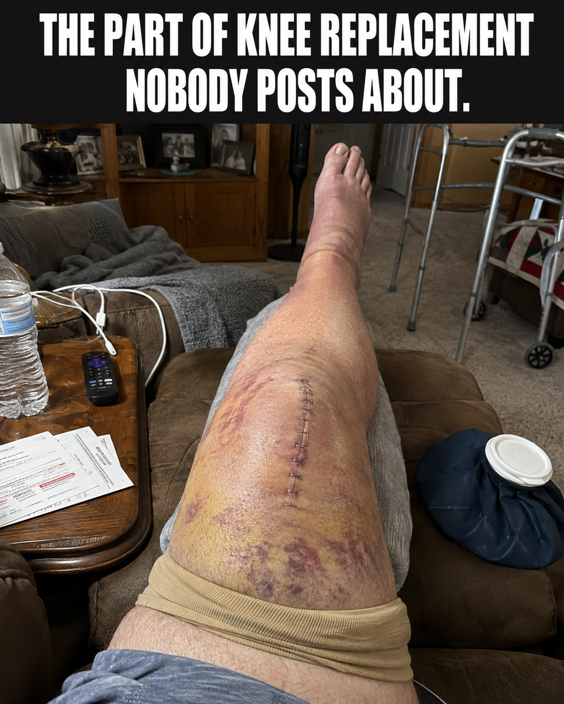 Kathy Miller Facebook ad: 12 years of bone-on-bone knee pain gone in 2 days?