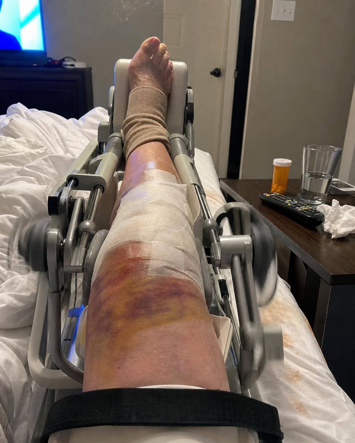 Linda Baker Facebook ad: 12 years of bone-on-bone knee pain gone in 2 days?