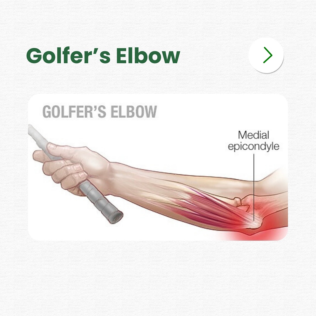 Orchard Health Clinic Facebook ad: Did you know - Golfer's Elbow tends to…
