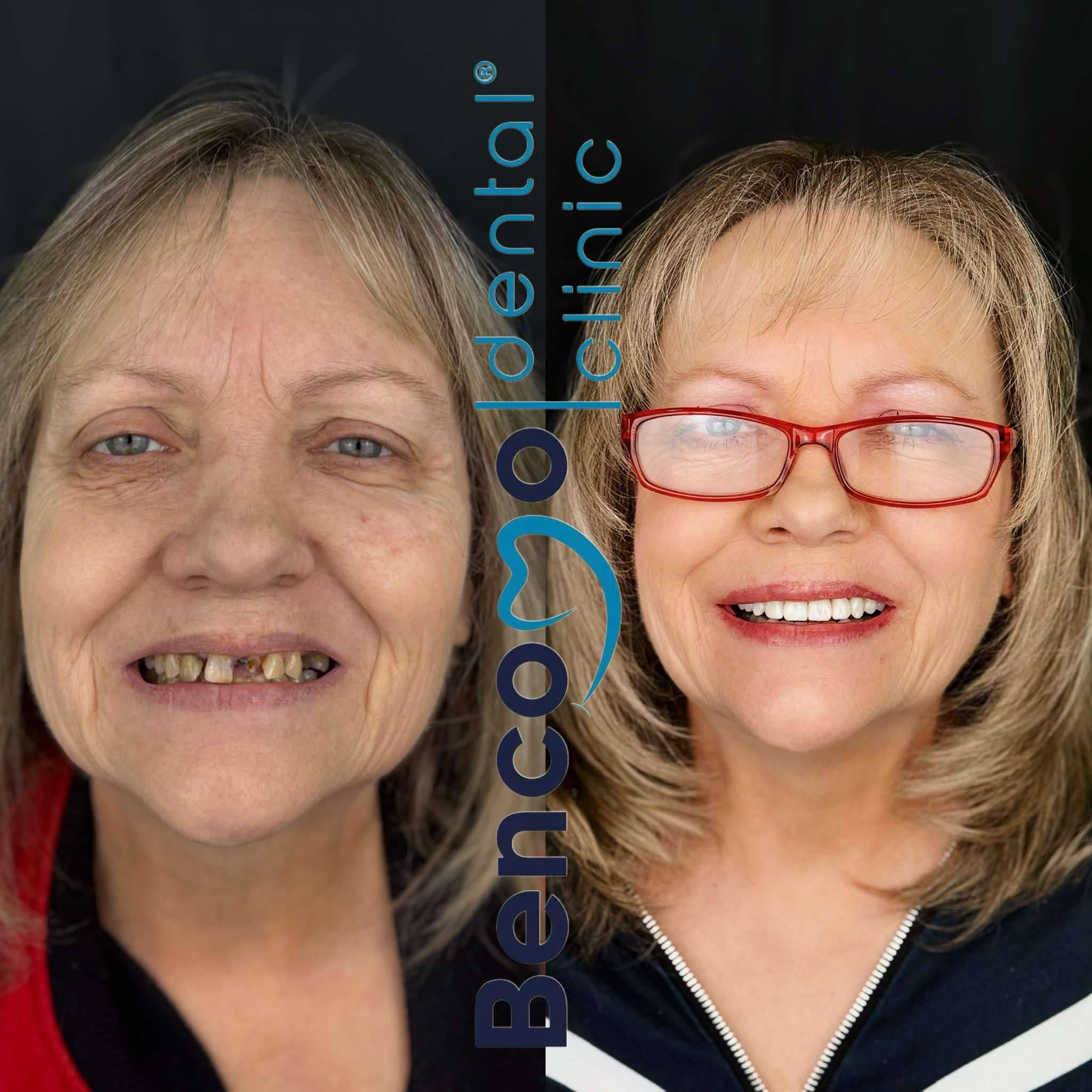 David Zamora Facebook ad: SMILE WITH CONFIDENCE
