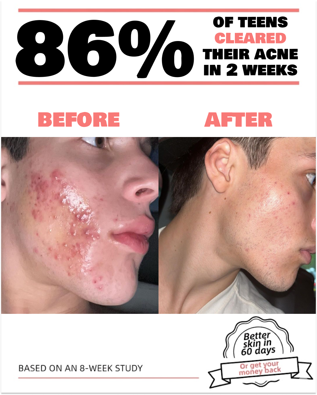 Anne's Skincare Blog Facebook ad