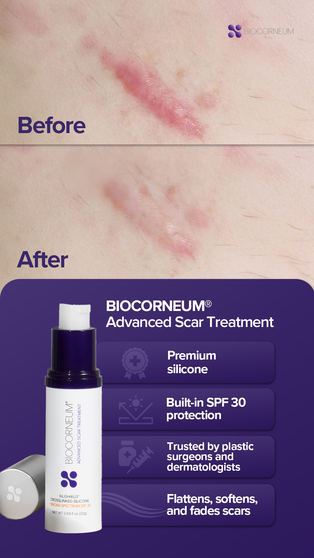 BIOCORNEUM + Facebook ad