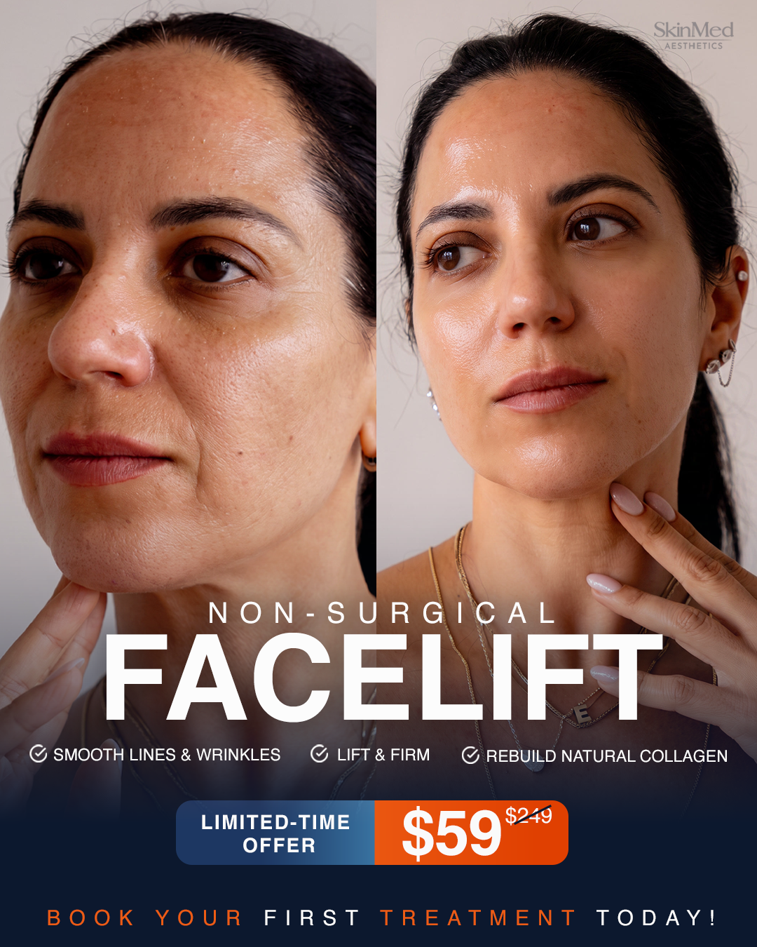 Skin Care Clinic Facebook ad: LIMITED SPOTS