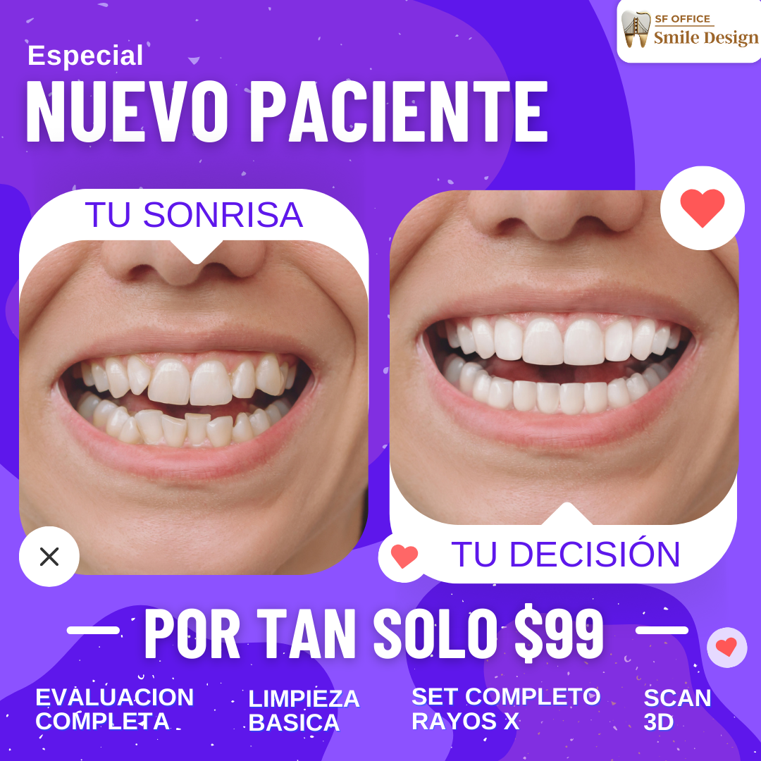 Smile Design SFO Facebook ad: Logra tu nueva sonrisa perfecta