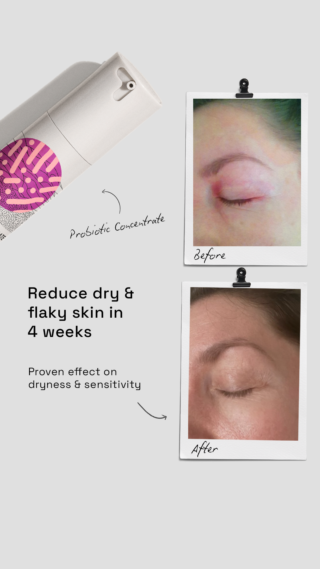 Skinome Facebook ad