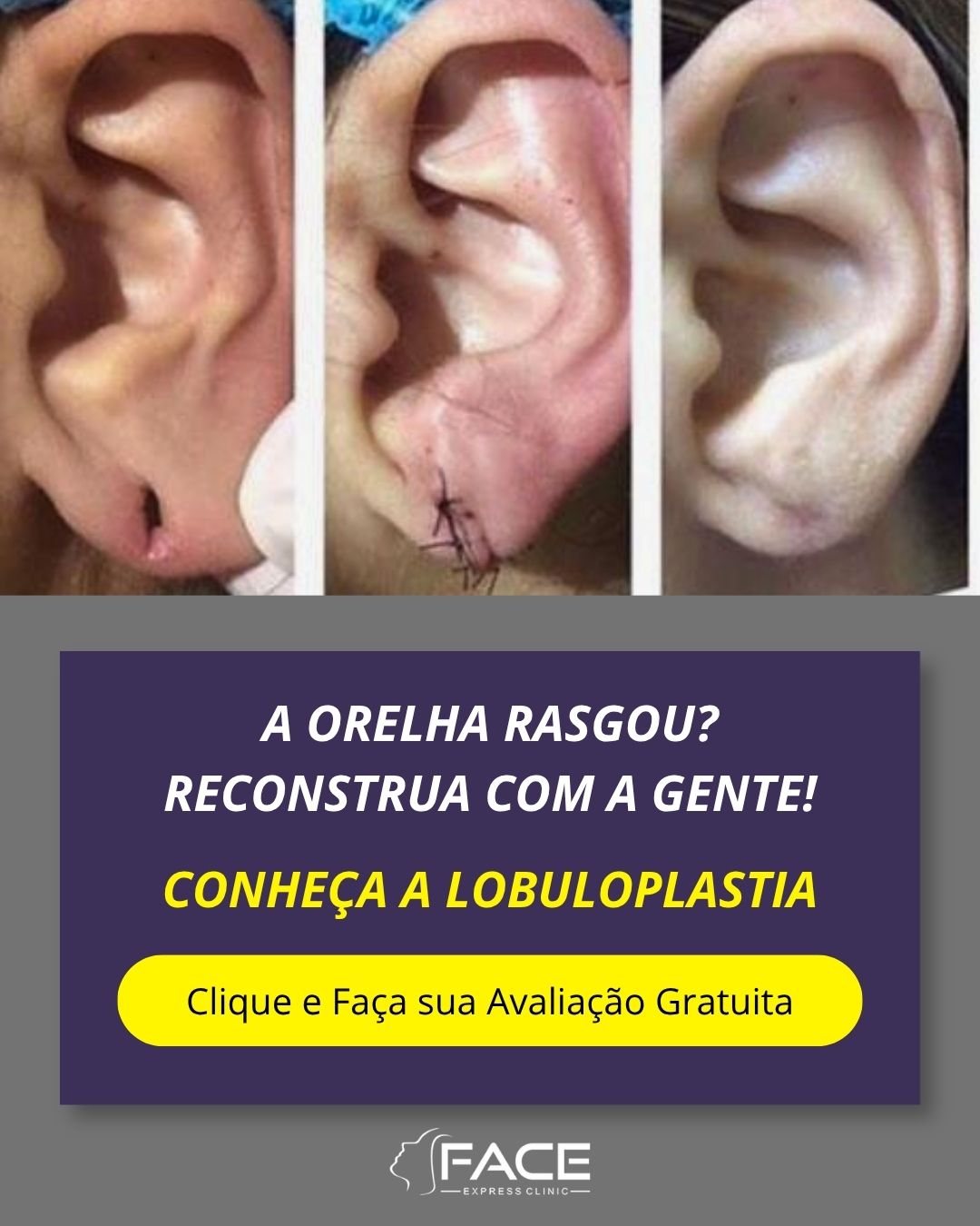 FACE Express Clinic Facebook ad