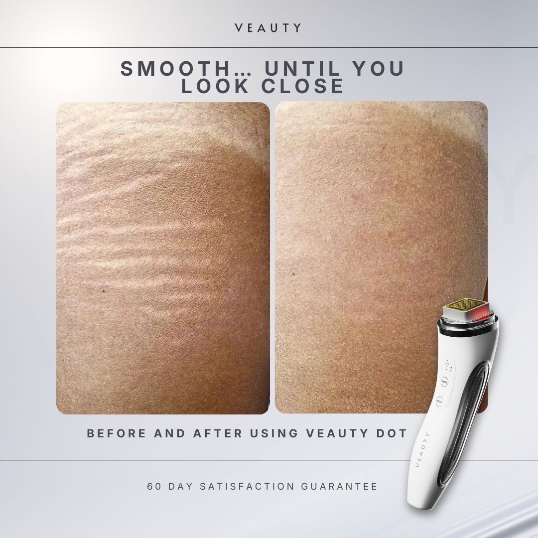 Veauty Facebook ad