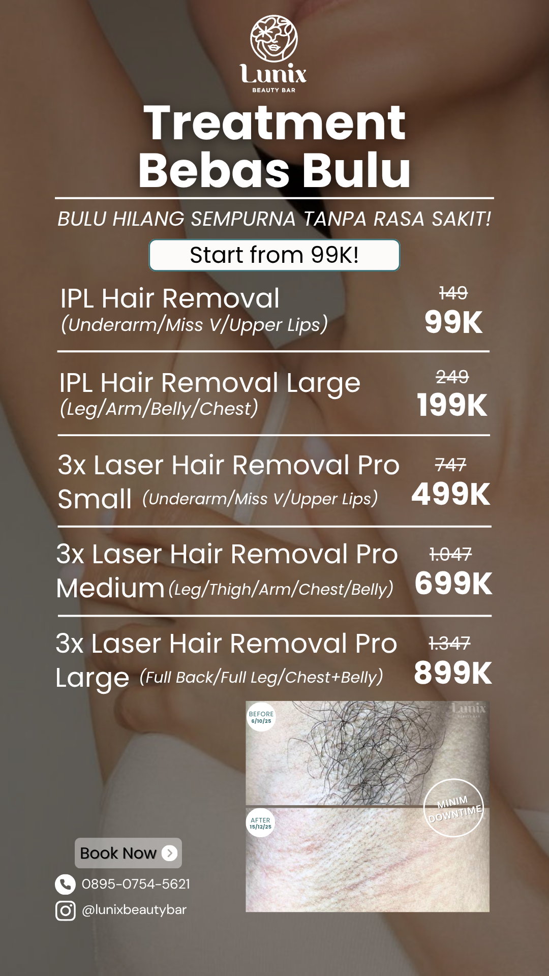 Lunix Beauty Facebook ad from Apr 1, 2026