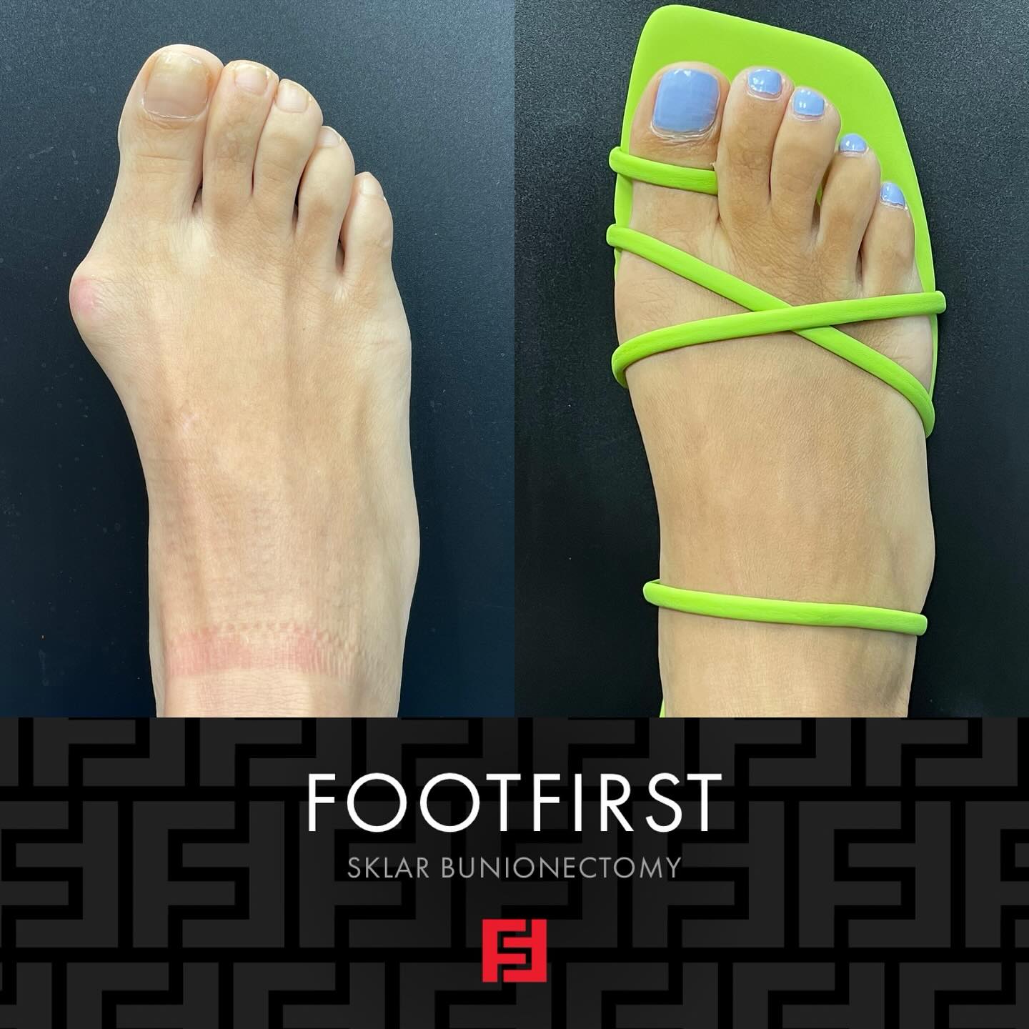 Foot First Podiatry Centers Facebook ad