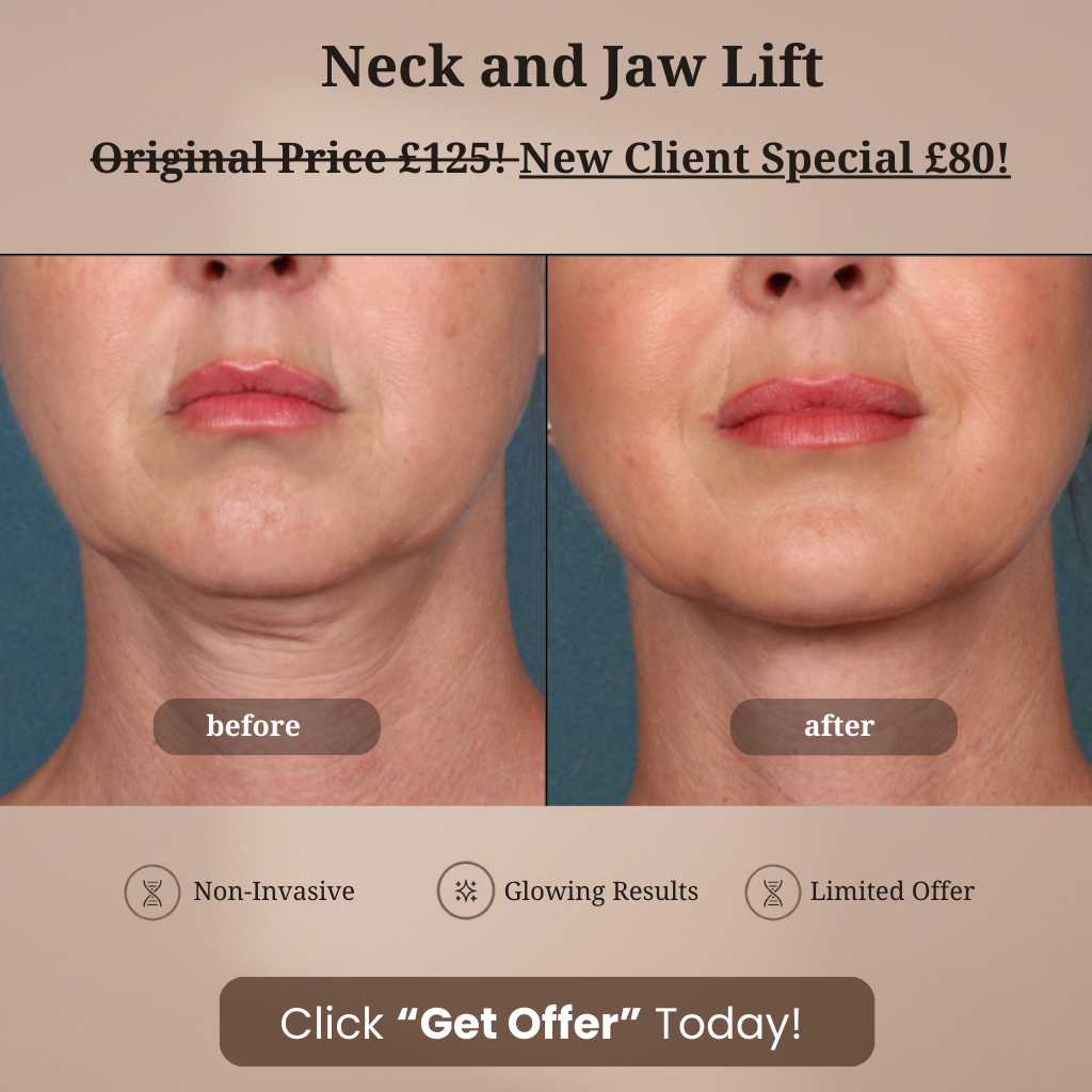 ML.aesthetics.sc Facebook ad: RF Microneedling £80 Was £125!