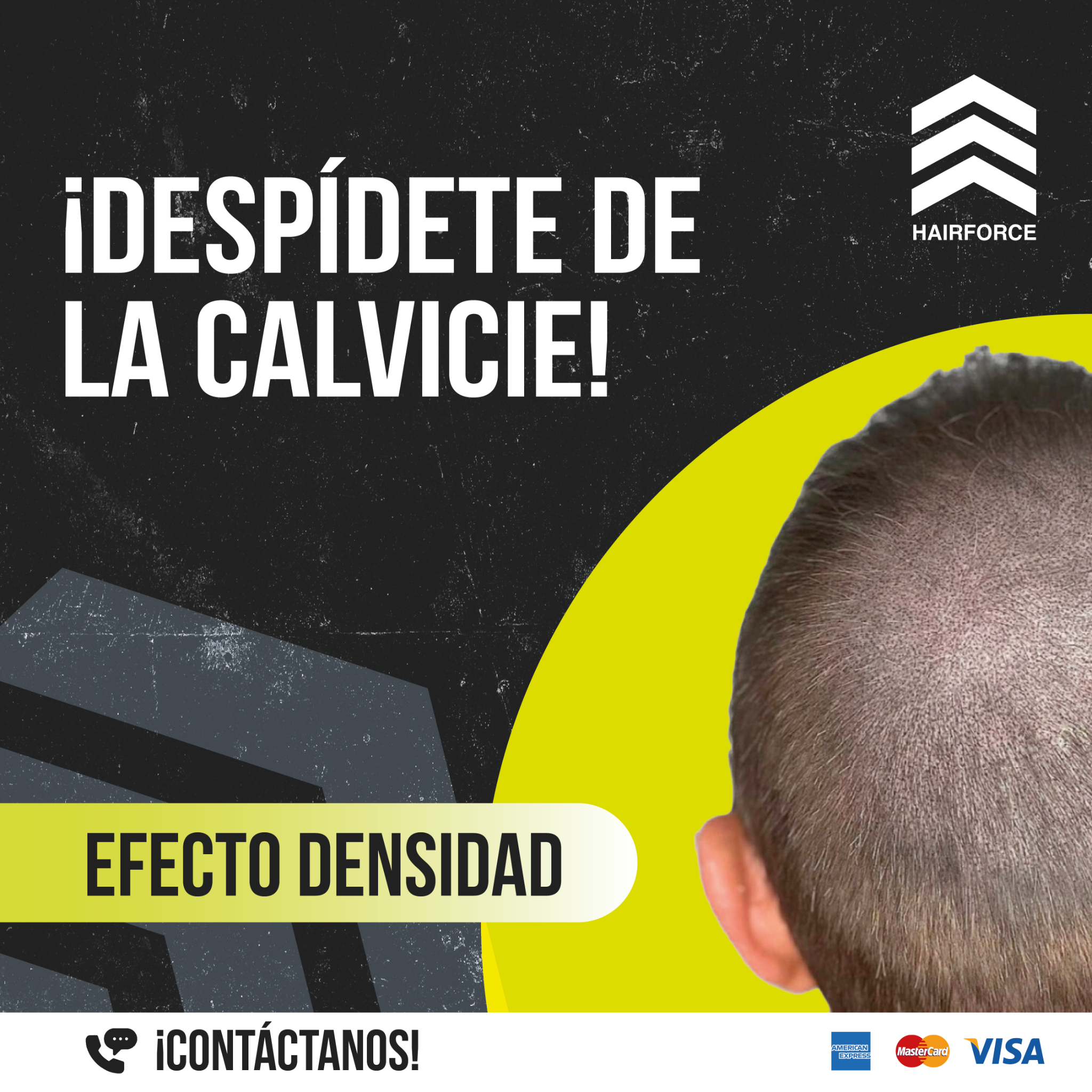 Micropigmentación capilar en México Facebook ad: ¡Vive sin calvicie!