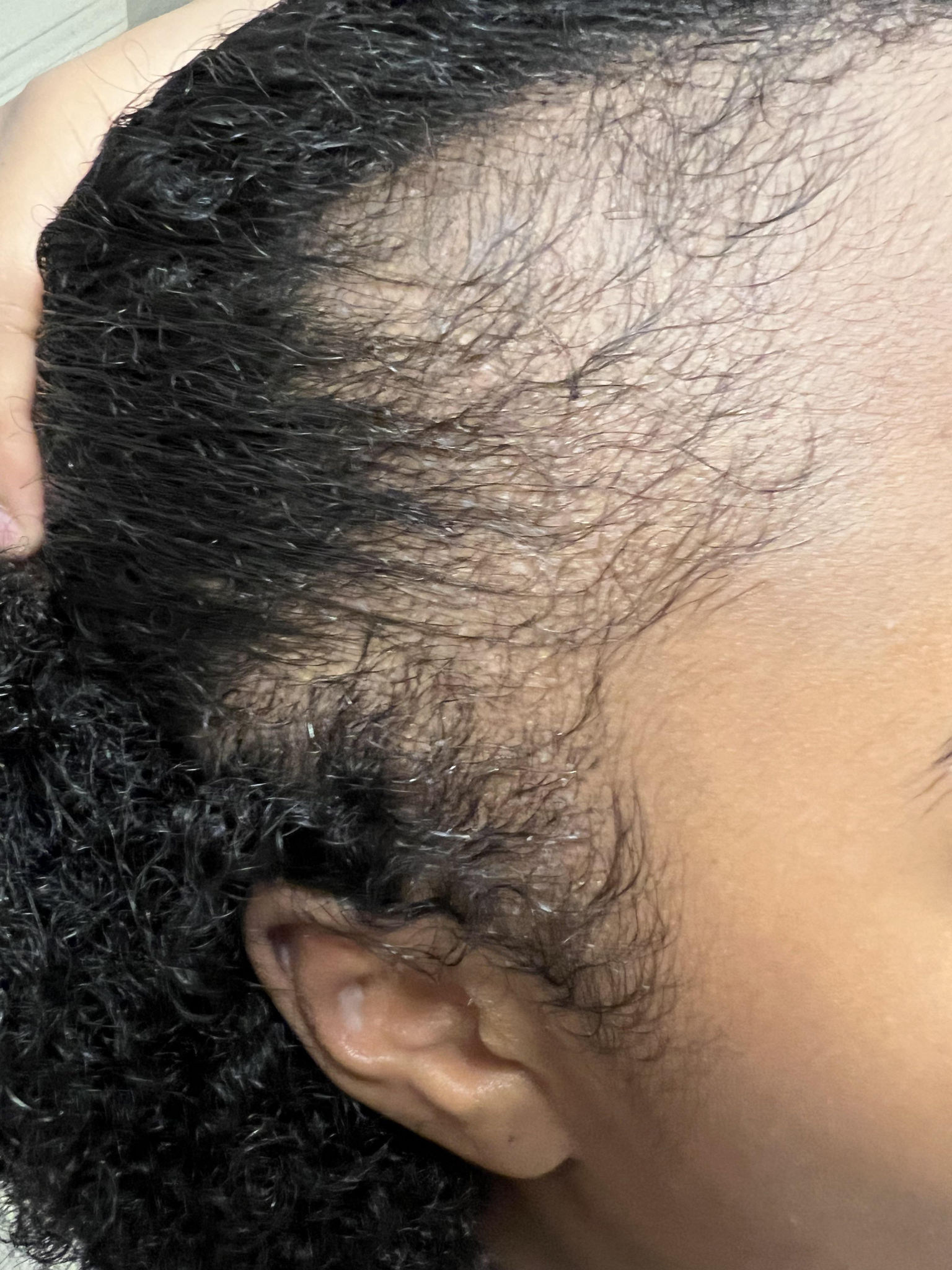 Jane Johnson Facebook ad: Read this if you losing your edges