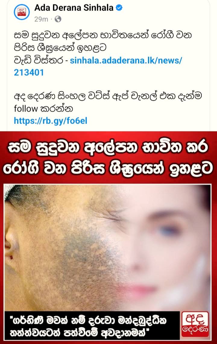 Ruu ceylon herbal products Facebook ad: ලොකු ගනන් දීලා cream ගාලා මූන සව්ත්තු උනාද?
