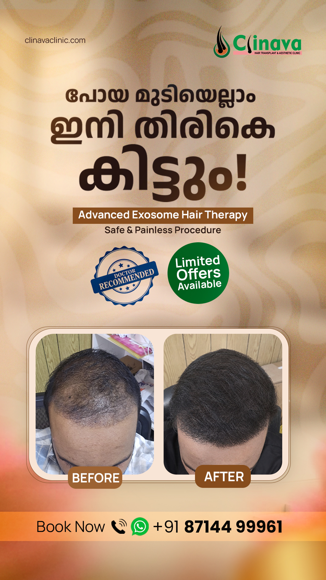 Clinava Hair Transplant & Aesthetic Clinic Facebook ad